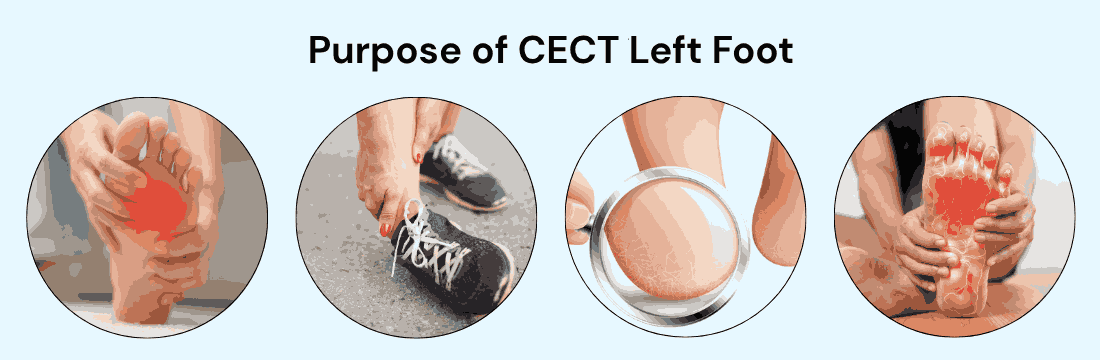 Purpose of CECT Left Foot